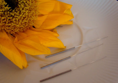 acupuncture needles